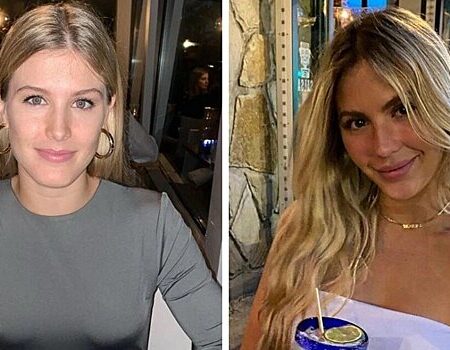 Eugenie Bouchard Reveals Gruesome Cupping Treatment Results After Birthday Glamour